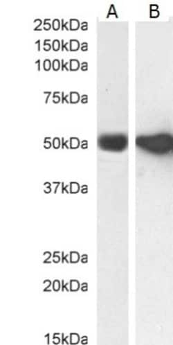 GFAP Antibody, Novus Biologicals 0.1mg; Unlabeled:Antibodies, Polyclonal